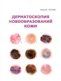 Дерматоскопия новообразований кожи Алексея Дмитриевича Гетьмана