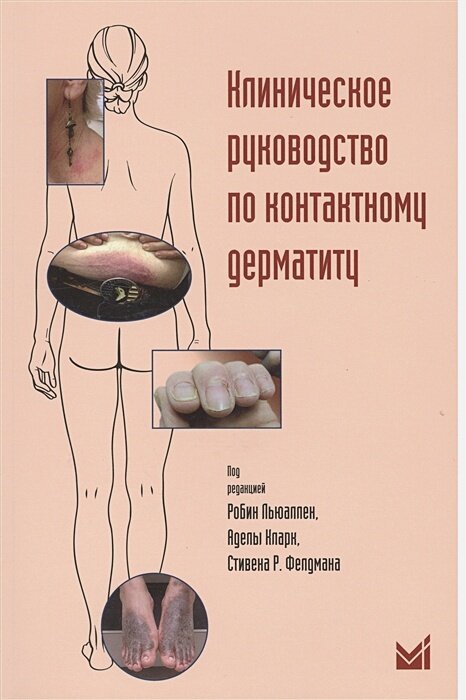 Клиническое руководство по контактному дерматиту. Диагностика и лечение в зависимости от области поражения 