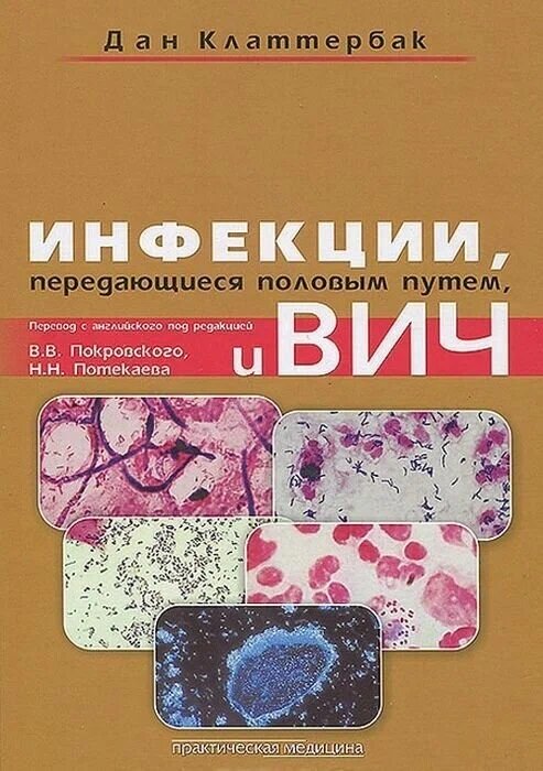 Инфекции, передающиеся половым путем, и ВИЧ-инфекция