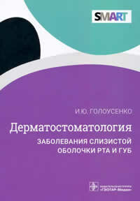 Дерматостоматология. Заболевания слизистой оболочки рта и губ